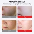 kojic-acid-brightening-face-cream.jpg