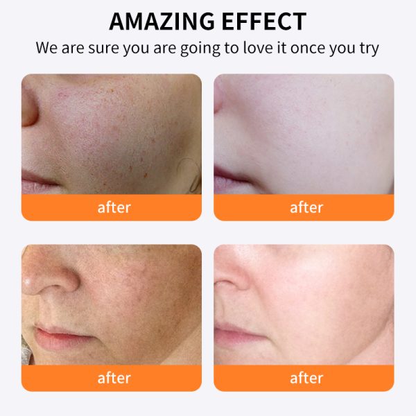 OEM-Skincare-Manufacturing-Vitamin-C-Whitening-Moisturizer.jpg