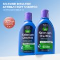 best-shampoo-for-dandruff-and-itchy-scalp-moisturizing-formula.jpg