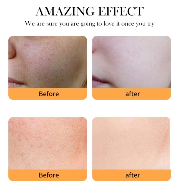 dark-spot-correction-brightening-moisturizer-face-cream.jpg