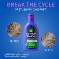 selenium-disulfide-1-percent-antidandruff-shampoo-for-dry-itchy-scalp.jpg