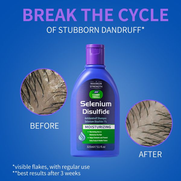 selenium-disulfide-1-percent-antidandruff-shampoo-for-dry-itchy-scalp.jpg