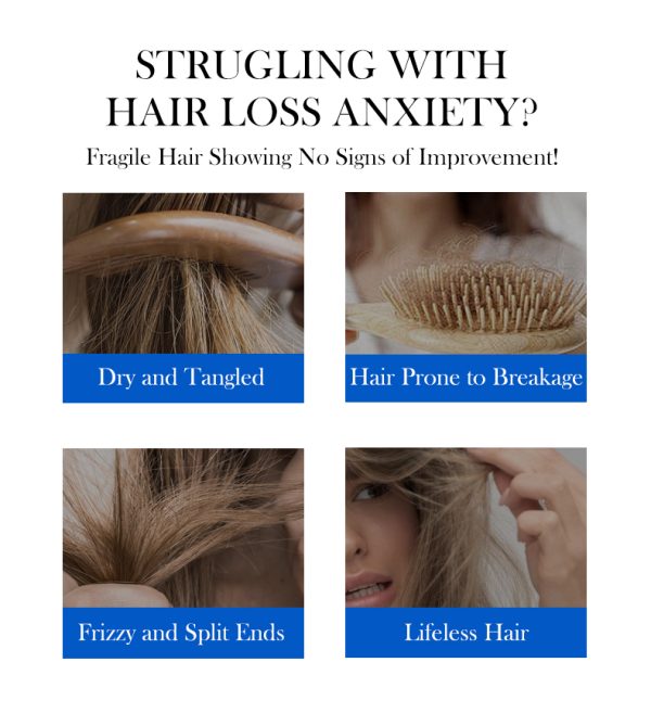 shampoo-selenium-disulfide-moisturizing-series.jpg