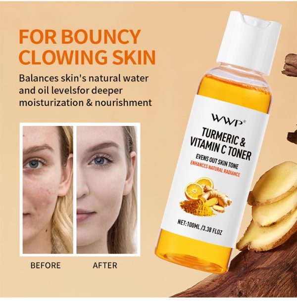 turmeric-toner-for-dark-spots-even-skin-tone.jpg turmeric-toner-for-dark-spots-even-skin-tone.jpg
