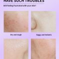 kojic-acid-anti-wrinkle-skin-elasticity-lotion.jpg