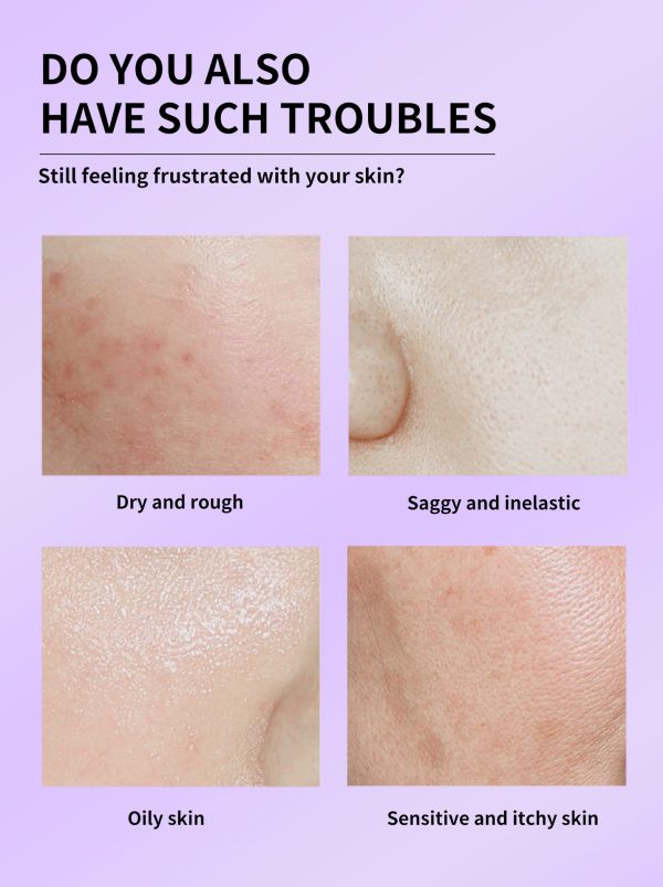 kojic-acid-anti-wrinkle-skin-elasticity-lotion.jpg kojic-acid-anti-wrinkle-skin-elasticity-lotion.jpg