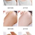 3-days-strong-whitening-aha-body-lotion-with-niacinamide-tocopherol-citric-acid.jpg