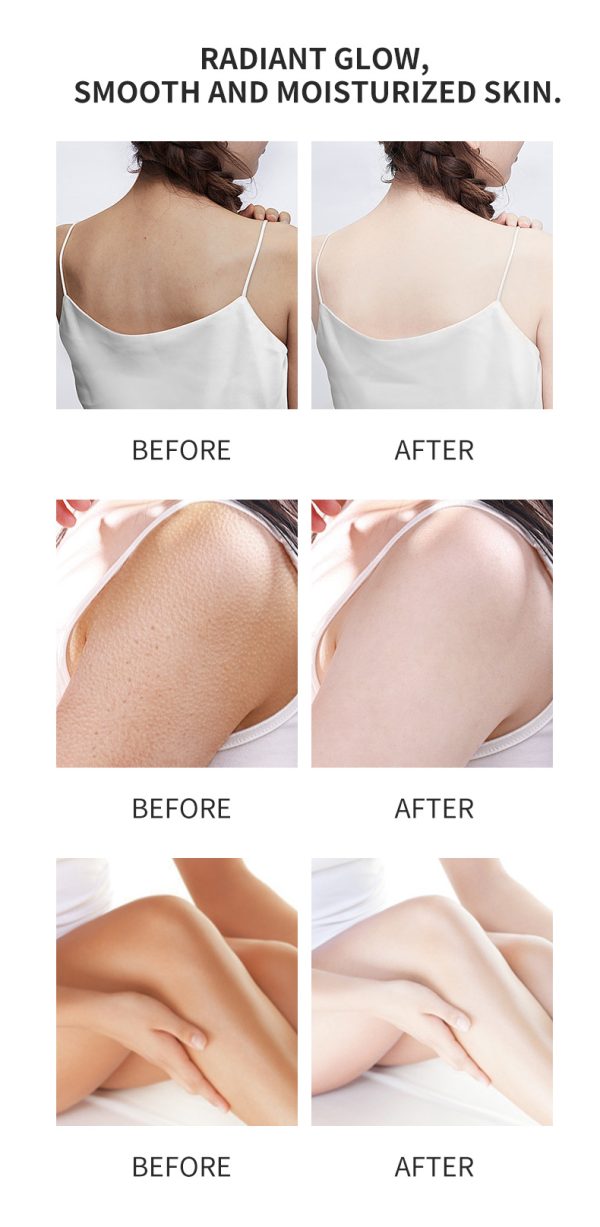 3-days-strong-whitening-aha-body-lotion-with-niacinamide-tocopherol-citric-acid.jpg 3-days-strong-whitening-aha-body-lotion-with-niacinamide-tocopherol-citric-acid.jpg